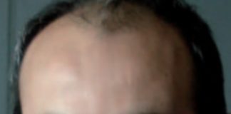 BARIŞ BIÇAKÇI KİMDİR?